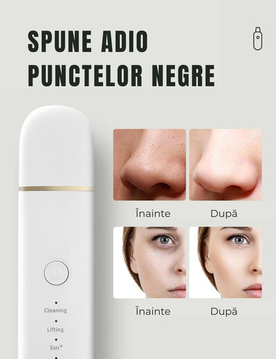 Dispozitiv de Curățare Facială cu Ultrasunete - Zainlux